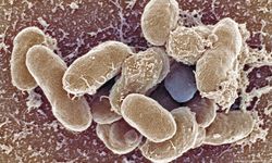 Vibrio bakterisi Türkiye kıyılarında da görülmeye başladı