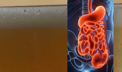 Bağırsakları kendi kendine alkol üreten adam, dışkı nakliyle iyileşti!